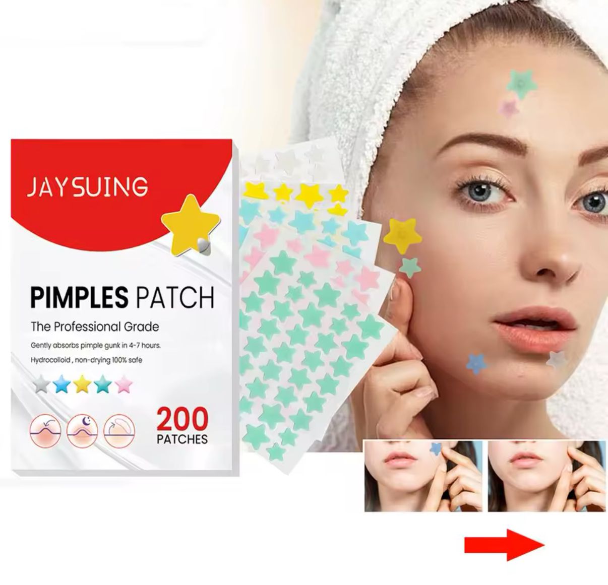 240pcs Pimple Patches Salicylic Acid Tea Tree Hydrocolloid Acne Patches